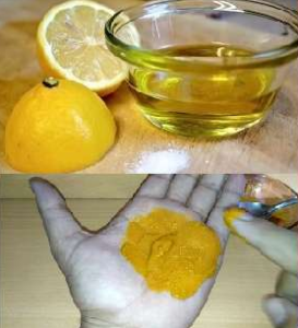 Apply Lemon Juice on the affected skin