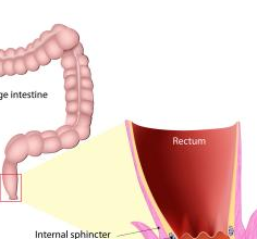 Itchy Bum Hole Meaning