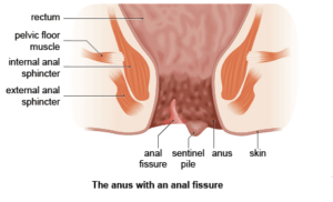 Thrust deep anus agony